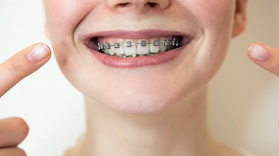 Does Orthodontic Treatment Hurt? What Patients Should Know In Las Vegas NV